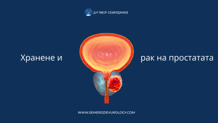 Read more about the article Хранене и рак на простатата